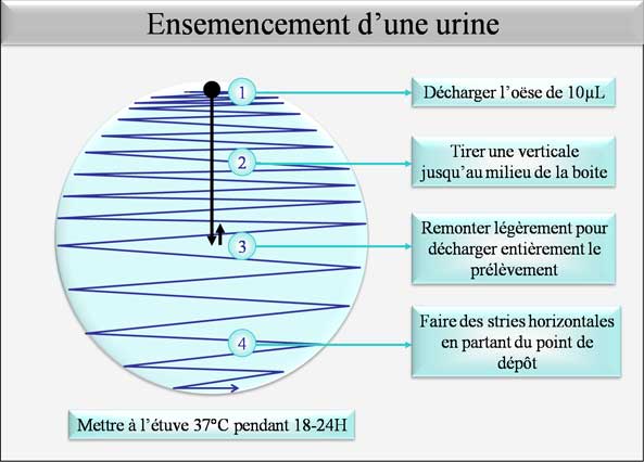 ensemensement d'une urine