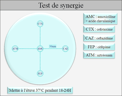 Test de synergie (bouchon de champagne)
