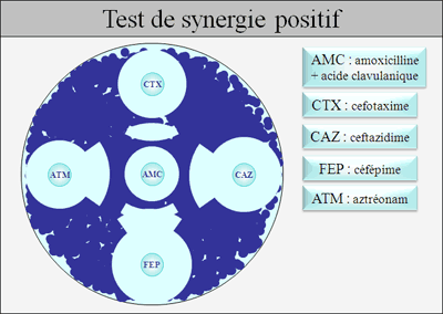 Test de synergie positif (bouchon de champagne)