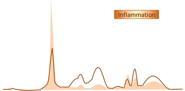 Tracé électrophorétique d'une inflammation