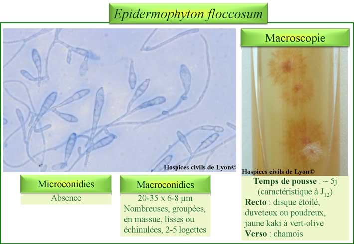 Epidermophyton floccosum